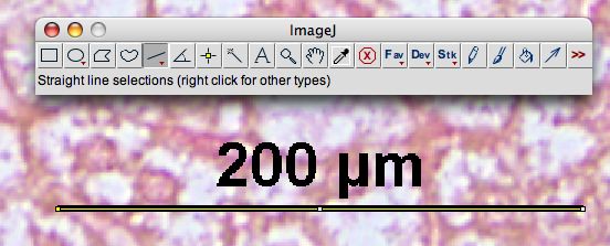 [scale bar]
