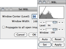 figure images/WindowLevel.png